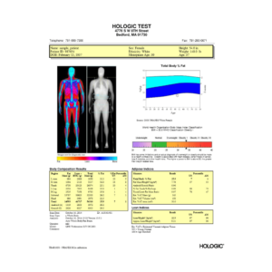 DEXA Scan Castle Hill, Sydney | Bone Density & Body Composition